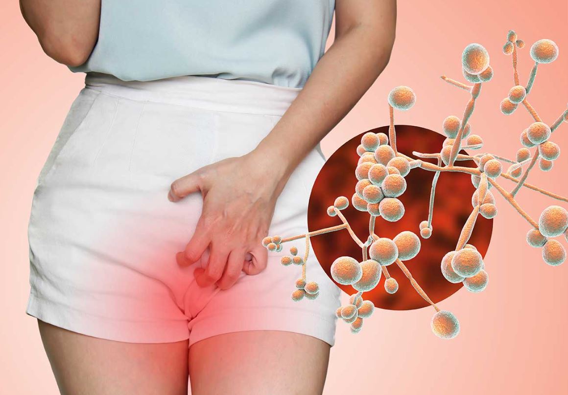 Candida vaginale