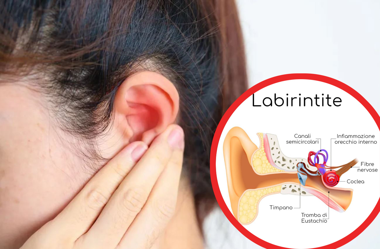 Labirintite