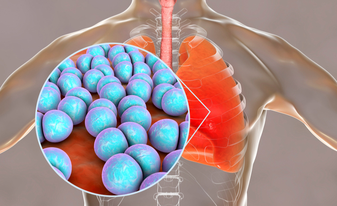 Setticemia